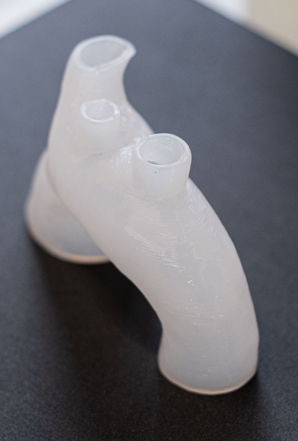 Partie du corps imprimée en 3D